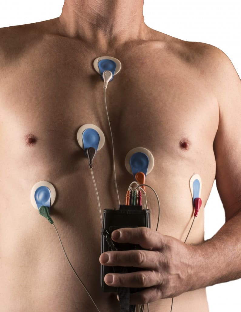 Holter monitoring
